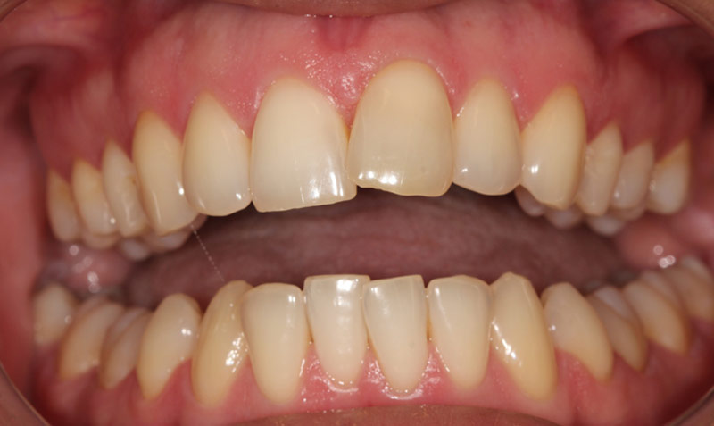 victoria dental whitening sachin sedani